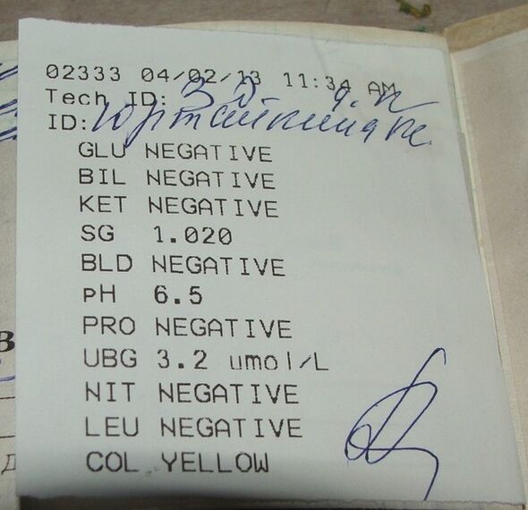 Výsledky mojej močovej analýzy pred FeMixal